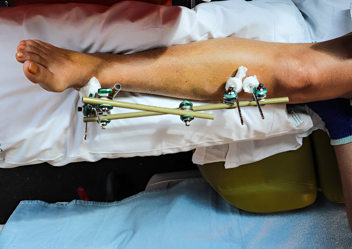 best orthopedic hospital near me
